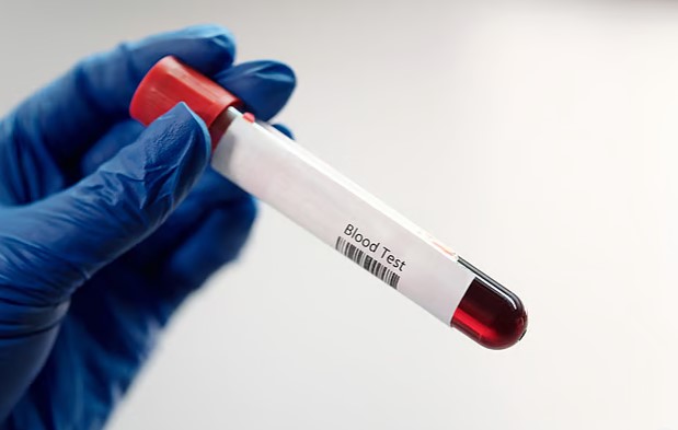 Can blood type change?। রক্তের গ্রুপের কি পরিবর্তন হতে পারে?